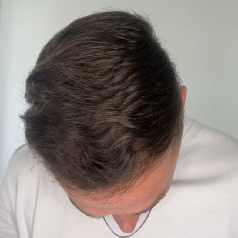 Casper (28) na