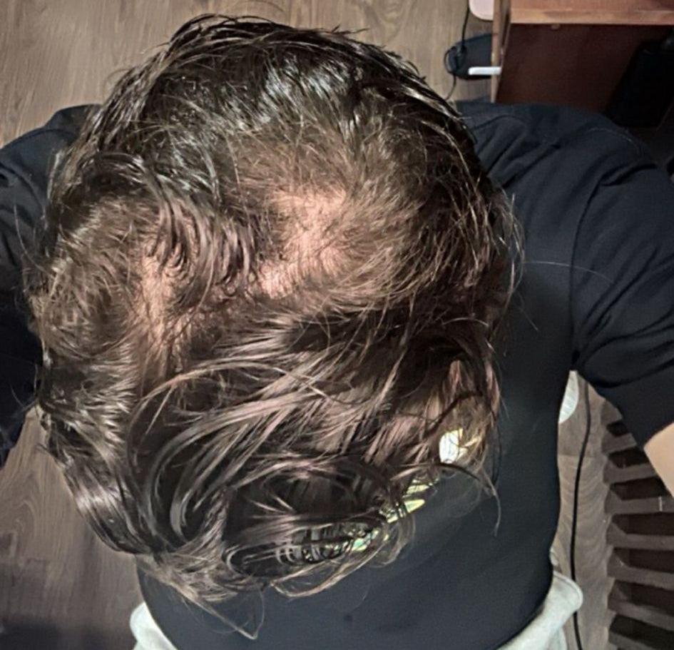 Elias (34) voor