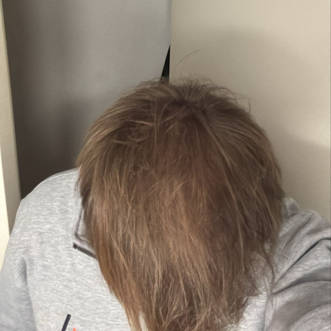 Bart (32) na